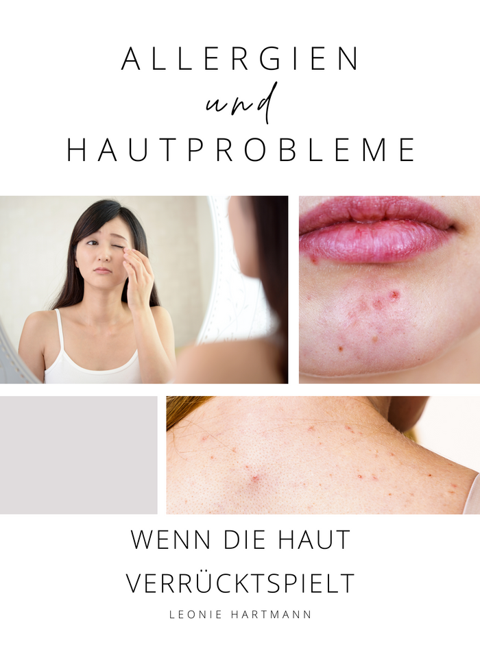 Allergien und Hautprobleme