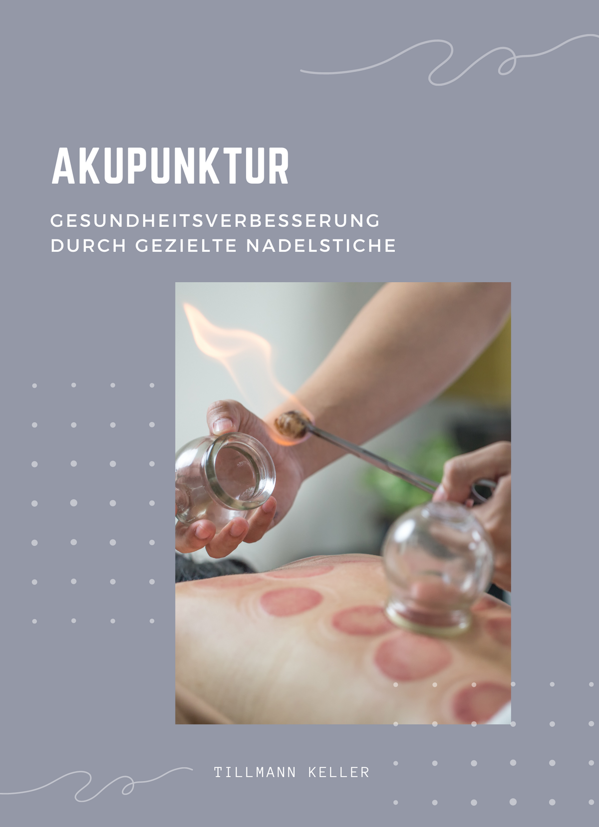 Akupunktur – Efory Books